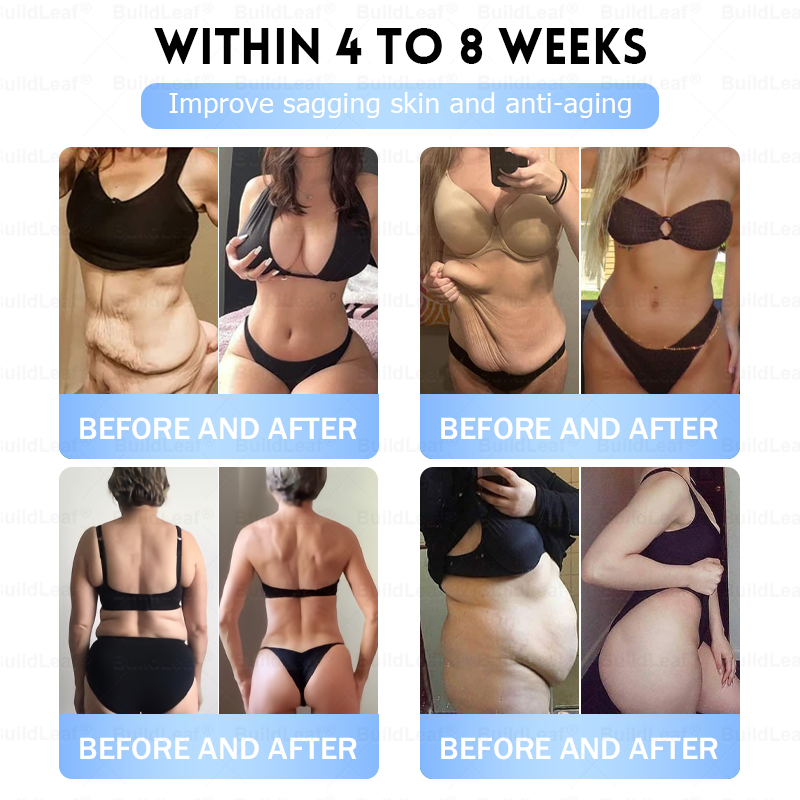 FDA Store·💎💎💎𝐁𝐮𝐢𝐥𝗱𝐋𝐞𝐚𝐟®𝐒𝐥𝐢𝐦 & 𝐅𝐢𝐫𝐦 𝐍𝐚𝐧𝐨 𝐌𝐢𝐜𝐫𝐨𝐧𝐞𝐞𝐝𝐥𝐞 𝐏𝐚𝐭𝐜𝐡 𝐰𝐢𝐭𝐡 𝐌𝐨𝐫𝐢𝐧𝐠𝐚, 𝐎𝐦𝐞𝐠𝐚-𝟑, 𝐂𝐨𝐥𝐥𝐚𝐠𝐞𝐧 𝐏𝐞𝐩𝐭𝐢𝐝𝐞𝐬, 𝐍𝐀𝐃 & 𝐍𝐌𝐍 𝐟𝐨𝐫 𝐎𝐛𝐞𝐬𝐢𝐭𝐲, 𝐂𝐚𝐫𝐝𝐢𝐨𝐯𝐚𝐬𝐜𝐮𝐥𝐚𝐫 𝐃𝐢𝐬𝐞𝐚𝐬𝐞, 𝐃𝐢𝐚𝐛𝐞𝐭𝐞𝐬, 𝐒𝐥𝐞𝐞𝐩 𝐀𝐩𝐧𝐞𝐚, 𝐉𝐨𝐢𝐧𝐭 𝐏𝐫𝐨𝐛𝐥𝐞𝐦𝐬, 𝐒𝐤𝐢𝐧 𝐅𝐢𝐫𝐦𝐢𝐧𝐠, 𝐀𝐧𝐭𝐢-𝐀𝐠𝐢𝐧𝐠, 𝐚𝐧𝐝 𝐌𝐨𝐫𝐞