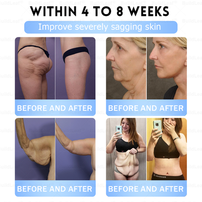 FDA Store·💎💎💎𝐁𝐮𝐢𝐥𝗱𝐋𝐞𝐚𝐟®𝐒𝐥𝐢𝐦 & 𝐅𝐢𝐫𝐦 𝐍𝐚𝐧𝐨 𝐌𝐢𝐜𝐫𝐨𝐧𝐞𝐞𝐝𝐥𝐞 𝐏𝐚𝐭𝐜𝐡 𝐰𝐢𝐭𝐡 𝐌𝐨𝐫𝐢𝐧𝐠𝐚, 𝐎𝐦𝐞𝐠𝐚-𝟑, 𝐂𝐨𝐥𝐥𝐚𝐠𝐞𝐧 𝐏𝐞𝐩𝐭𝐢𝐝𝐞𝐬, 𝐍𝐀𝐃 & 𝐍𝐌𝐍 𝐟𝐨𝐫 𝐎𝐛𝐞𝐬𝐢𝐭𝐲, 𝐂𝐚𝐫𝐝𝐢𝐨𝐯𝐚𝐬𝐜𝐮𝐥𝐚𝐫 𝐃𝐢𝐬𝐞𝐚𝐬𝐞, 𝐃𝐢𝐚𝐛𝐞𝐭𝐞𝐬, 𝐒𝐥𝐞𝐞𝐩 𝐀𝐩𝐧𝐞𝐚, 𝐉𝐨𝐢𝐧𝐭 𝐏𝐫𝐨𝐛𝐥𝐞𝐦𝐬, 𝐒𝐤𝐢𝐧 𝐅𝐢𝐫𝐦𝐢𝐧𝐠, 𝐀𝐧𝐭𝐢-𝐀𝐠𝐢𝐧𝐠, 𝐚𝐧𝐝 𝐌𝐨𝐫𝐞